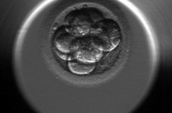 My first baby, 8 cells old